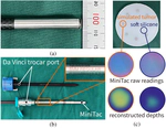 [RA-L24] MiniTac: An Ultra-Compact 8 mm Vision-Based Tactile Sensor for Enhanced Palpation in Robot-Assisted Minimally Invasive Surgery